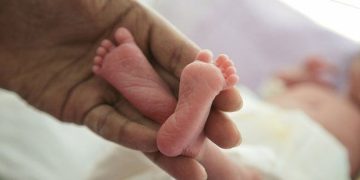 இரண்டு ஆணுறுப்புகளுடன் பிறந்த அதிசய குழந்தை!