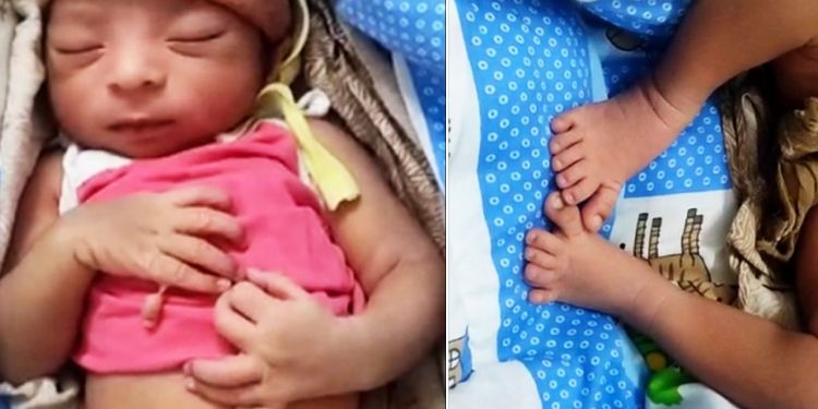 24 விரல்களுடன் பிறந்த அதிசயக் குழந்தை!