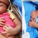 24 விரல்களுடன் பிறந்த அதிசயக் குழந்தை!