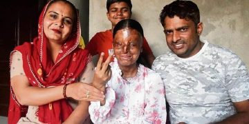 ஆசிட் வீச்சால் 3 வயதில் பார்வையிழந்த மாணவி பள்ளி டாப்பர் ஆகி சாதனை!