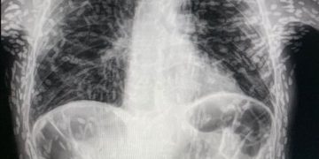 இணையத்தை உலுக்கும் நபர் ஒருவரின் ஸ்கேன் புகைப்படம்!