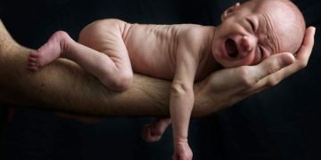 இந்தியாவில் அதிகரிக்கும் குறைப்பிரசவங்கள்; அதிர்ச்சி தரும் ஐ.நா.!